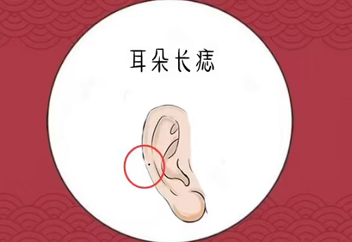 耳朵上长痣好吗 耳朵上长痣好吗女孩