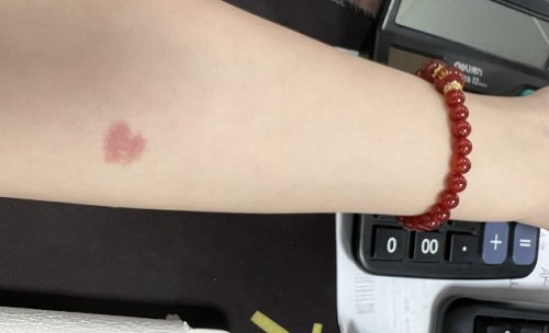 最有福气的10处胎记 仙转世胎记的位置