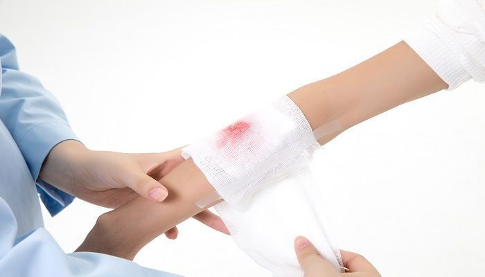 梦见手臂什么意思 梦见手臂预示什么