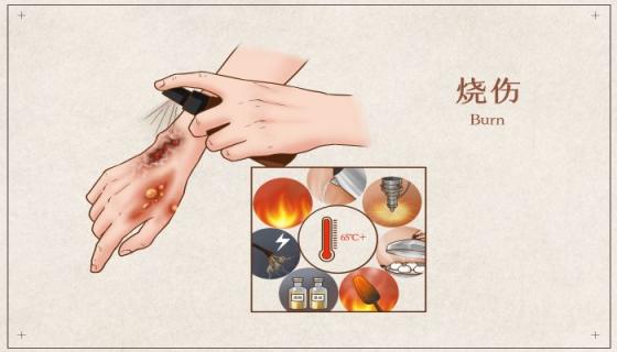 梦见水泡是什么意思 梦见水泡是什么预兆