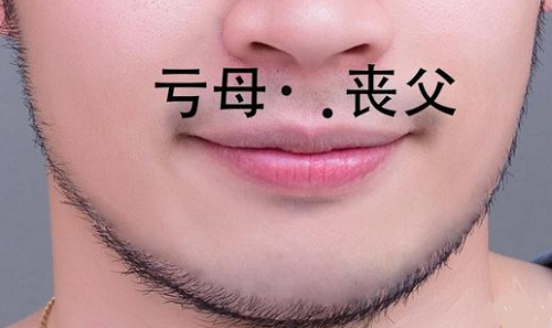 男人双生痣可以去掉吗, 男人双生痣的命运
