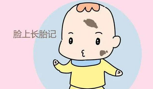 菩萨送的孩子带胎记可以去掉吗图片 菩萨送的孩子带胎记左脚上有什么说法