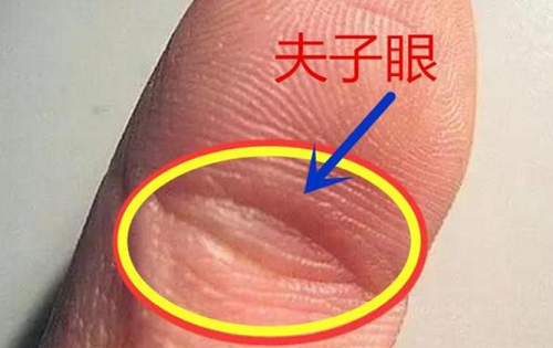夫子眼的女人什么命家境不好 夫子眼的女人什么命元宝纹