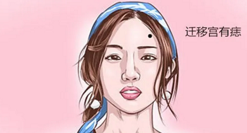 额头迁移宫有痣 迁移宫有痣有什么好处